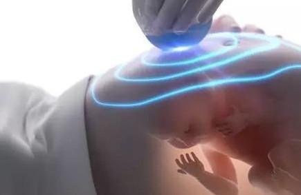 孕检发现胎儿脐带绕颈一周，要如何纠正呢？