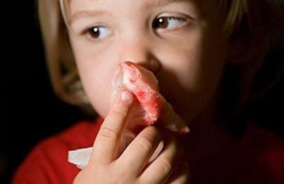 宝宝流鼻血是什么原因？怎么样给宝宝止血呢？