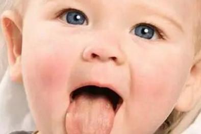 宝宝这些症状可能是上火了，宝妈要注意哦