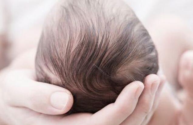 小儿白发是怎么回事 宝妈一时疏忽竟让宝宝有白发