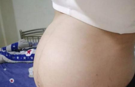 怀孕后肚子却越来越小，知道真相妈妈都崩溃痛哭了......
