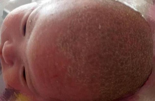 满月宝宝终生不长头发！竟因为宝妈做错这件事！