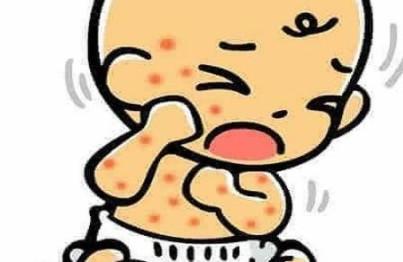 宝宝湿疹时，哺乳期妈妈该怎么做？？？