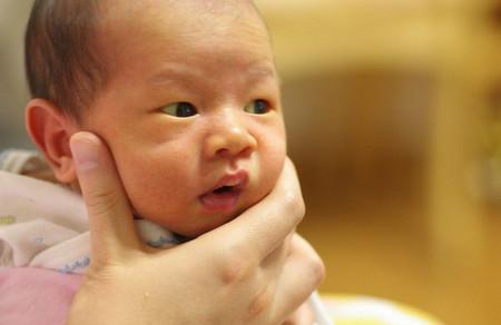 新生儿黄疸有哪几种病症？黄疸必须停喂母乳吗？