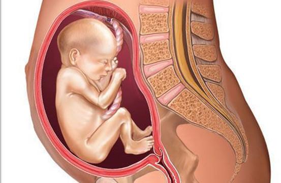 胎儿臀位什么时候纠正？如何纠正？