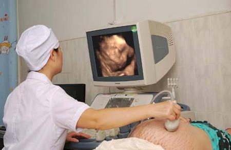 做四维的注意事项有哪些？四维彩超报告单怎么看？