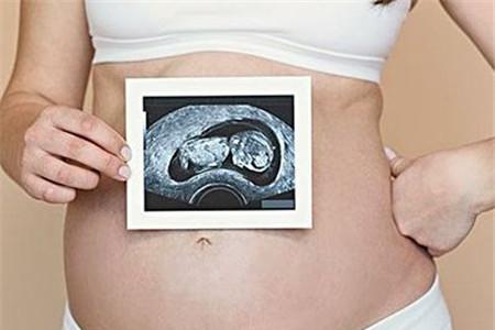 双子宫可以怀双胞胎吗 你不知道的神奇小知识
