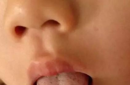 从宝宝舌头判断健康信号，这6点是关键！
