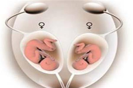 双子宫纵隔是什么意思 记得与双子宫区分