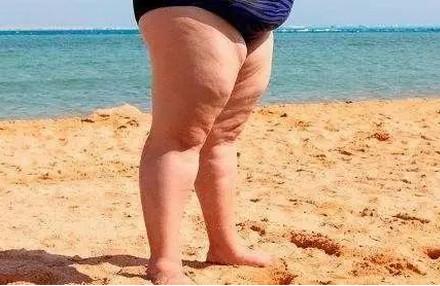 女人先胖腿的原因是什么？产后臀部和腿部如何减肥?