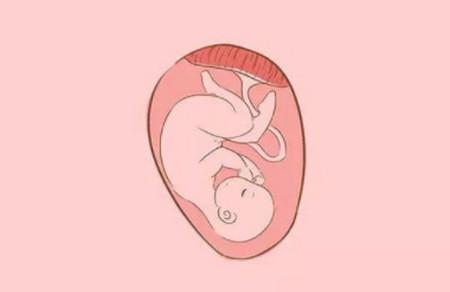 胎位和宝宝性别真的有关吗？