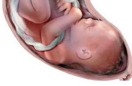 胎儿为什么会出现脐带绕颈？如何才能避免脐带绕颈的出现呢？