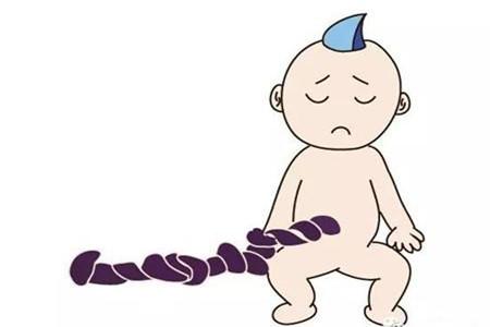 脐带扭转怎么发现 这些方法可以救命