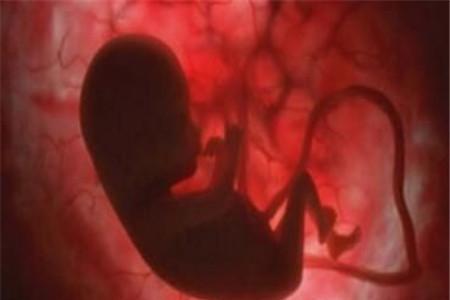 脐带扭转多久会死亡 脐带异常处理一定要及时