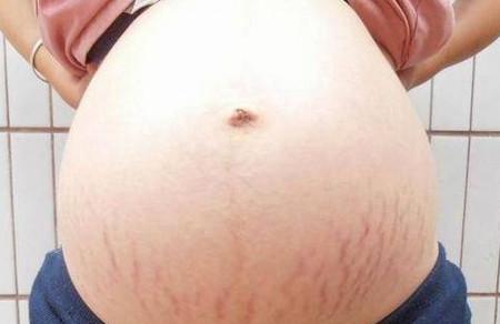 孕妈肚脐凸出是男孩，凹进去是女孩？