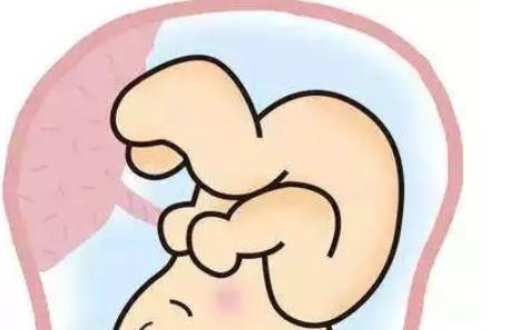 你知道吗？子宫里的这个东西会害死宝宝！