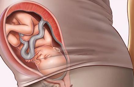 快到临产期，胎儿还没有入盆是怎么回事？