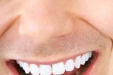 牙周炎很毁性能力