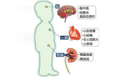 4类高血压患者不需要终身服药！有你吗？