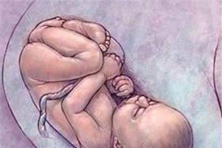 羊水浑浊为什么会缺氧 胎儿缺氧要谨慎