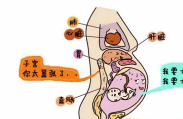 孕期腹痛为哪般？你心里有谱了吗？