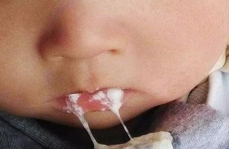 婴幼儿总吐奶是因为啥？四个字让你秒懂这其中的原因！