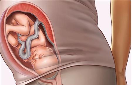初产妇什么时候入盆 胎儿入盆时间需知晓