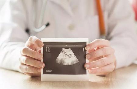 整个孕期，B超究竟都能查出些什么？