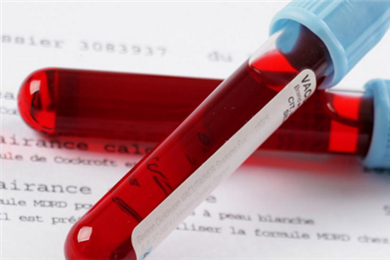 抽血验孕怎么看化验单 简单3步就能知道是否怀孕