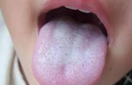 学会舌诊，宝宝身体状况早知道！