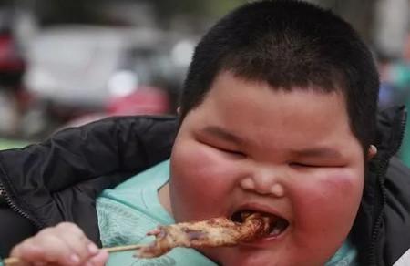 引起孩子肥胖的原因是什么？