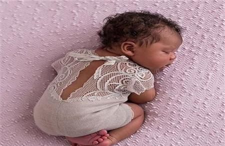 怎么让剖腹产的疤痕消失