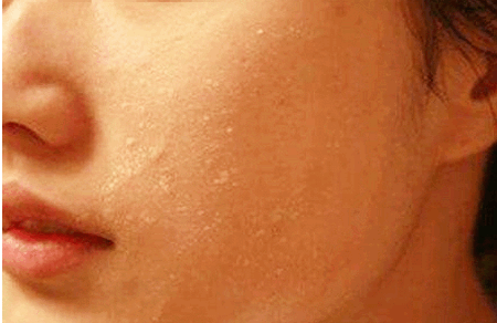 宝宝手长倒刺、准妈妈身上起皮？该怎么办？