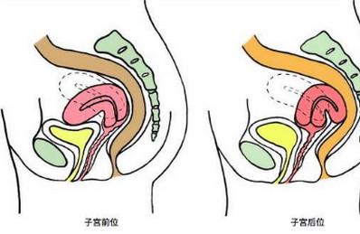 怀孕生娃跟子宫位置有关吗？子宫后位还能生娃吗？
