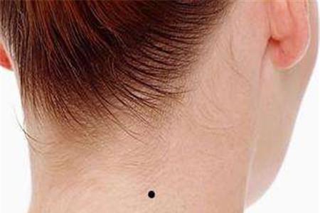 女生私处有痣代表什么 隐私部位要上心