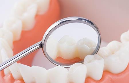 孕妇牙龈出血怎么办 这六招可有效缓解牙龈问题