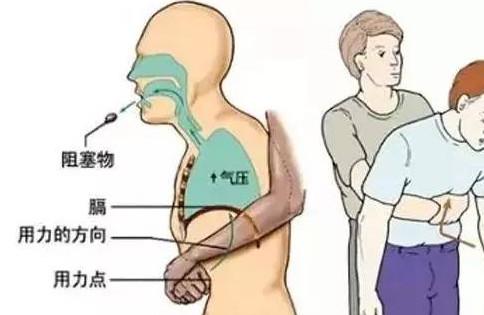7个月大的宝宝被“噎死”，宝宝噎食该如何应对？