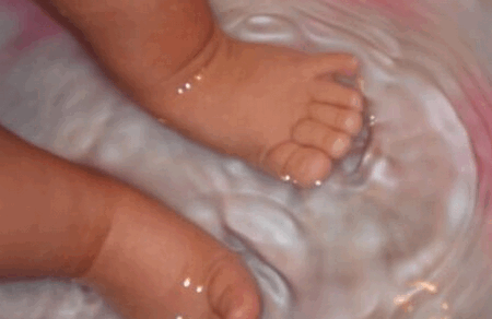孩子泡脚受了伤，你知道6岁以下幼儿不宜热水泡脚吗？