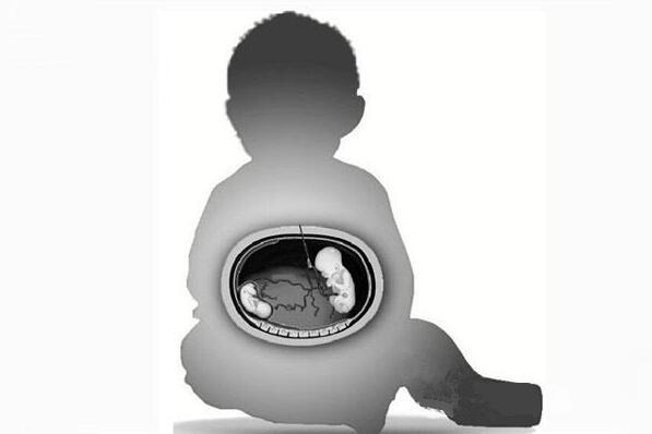 寄生胎是怎么形成的