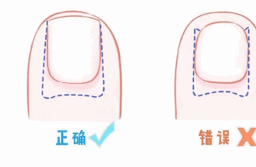 剪指甲还有大学问？你们都给宝宝剪对了吗？