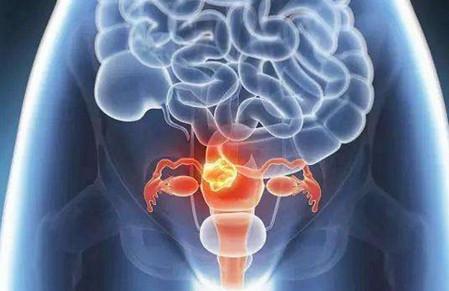 多囊卵巢综合症真的不能治好吗？