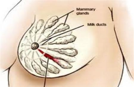 乳腺炎奶水有脓怎么办 这些治疗可选择