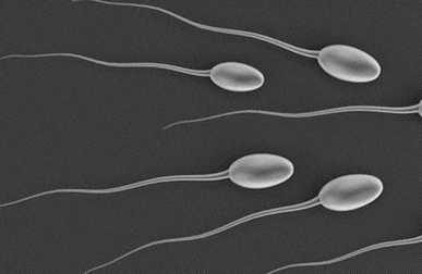 精子畸形率高会造成胎停育吗？