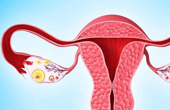 什么是卵巢过度刺激综合征？