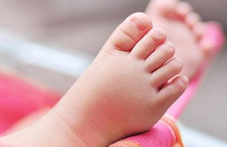 不会爬的宝宝穿了婴儿鞋, 会对足部发育有影响吗?