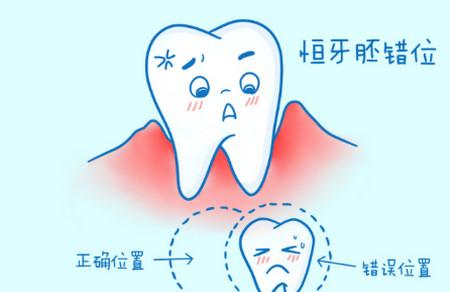 乳牙迟早要换的，蛀了不用管？宝宝平时的牙齿护理特重要
