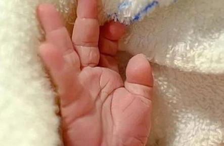 皮肤科医师：照顾婴儿皮肤，别天天洗澡