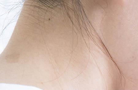 haba油可以去妊娠纹吗 孕期如何预防妊娠纹