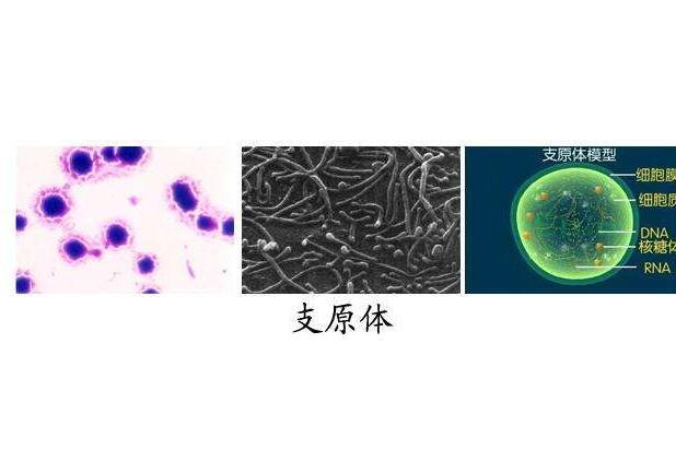 小儿支原体感染是什么原因引起的