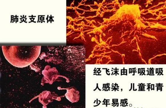 小儿支原体肺炎的并发症有哪些